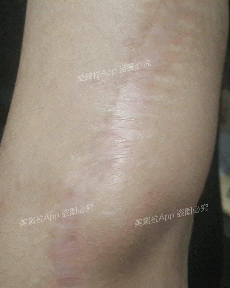 5次,我的愿望实现了